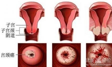 宫颈无码,无码科普，了解宫颈的秘密